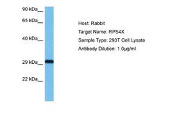 RPS4X Rabbit anti-Human, Polyclonal, Novus Biologicals 0.1ml; Unconjugated:Antibodies,
